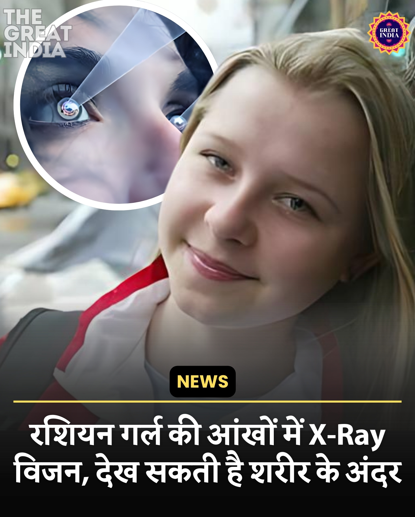 Natasha Demkina XRay Vision